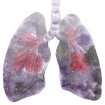 روز جهانی ریه | بیمارستان سیدالشهداء یزد