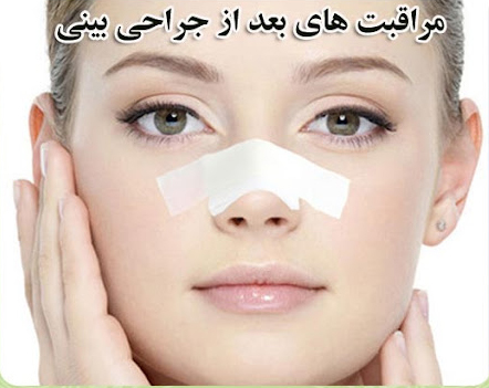 نکاتی که باید بعد از جراحی زیبایی بینی(رینوپلاستی) رعایت کنید | بیمارستان سیدالشهداء یزد