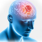 هفته آگاهی از تومور مغزی | بیمارستان سیدالشهداء یزد