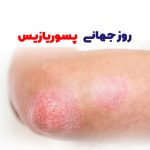روز جهانی پسوریازیس | بیمارستان سیدالشهداء یزد