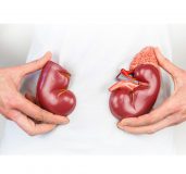 روز حمایت از بیماران کلیوی | بیمارستان سیدالشهداء یزد