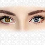 روز هتروکرومیا (ناهم‌رنگی عنبیه)