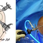 پمفلت آرتروسكوپي شانه | بیمارستان سیدالشهداء یزد