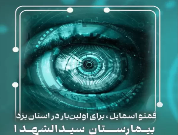 انجام موفقیت‌آمیز عمل فمتو اسمایل برای نخستین‌بار در استان یزد | بیمارستان سیدالشهداء یزد
